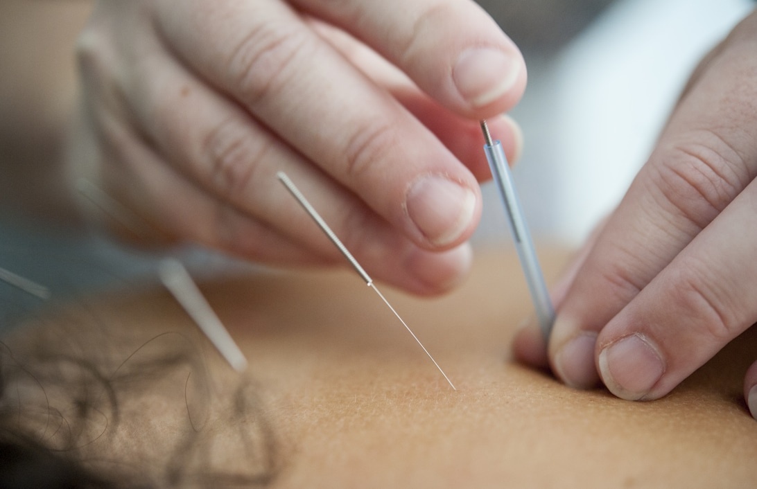 De 5 mest effektiva massageteknikerna för att lindra ryggsmärta